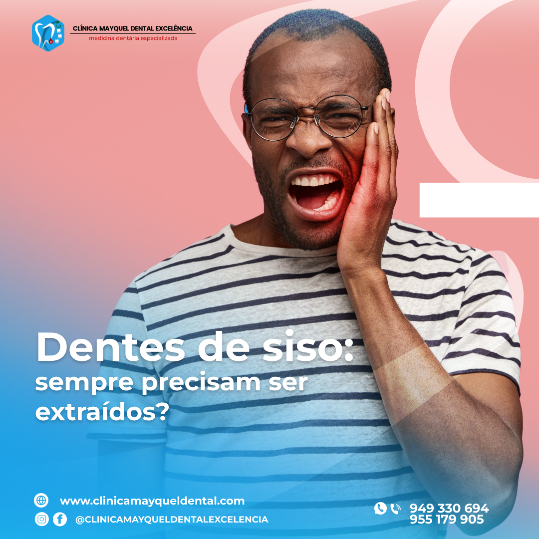 Dentes de Siso: Sempre Precisam Ser Extraídos?